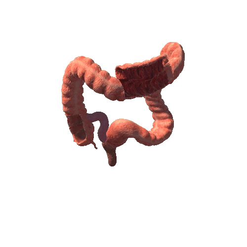 large intestine LO prefab